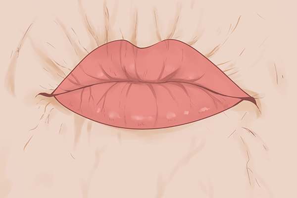 嘴唇上起泡怎样可以快速消除 嘴巴上长小水泡的原因
