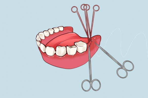 牙龈肿痛吃什么药有效，该如何预防牙龈